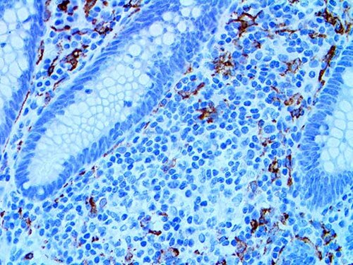 IHC of CD163 on an FFPE Colon Tissue